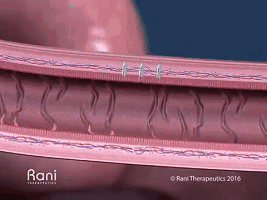 小小药丸机器人 也许将变革生物制剂的给药方式