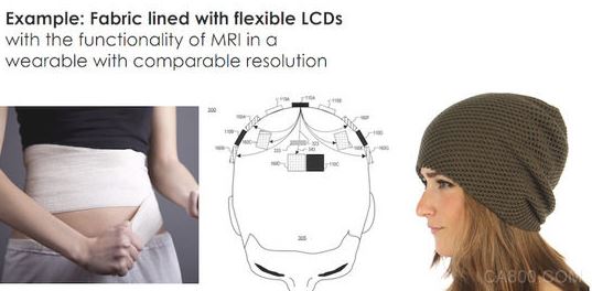 可穿戴,MRI,全新成像