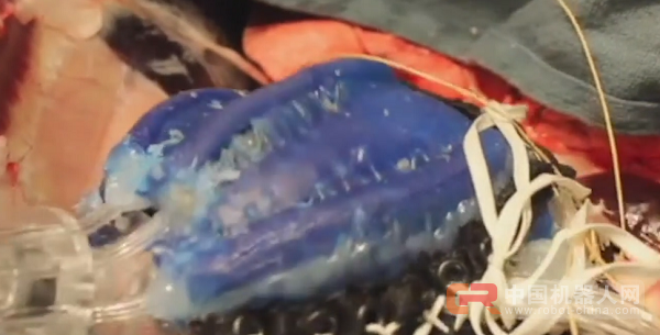 专家称，蛆虫式软体机器人，是体内送药的最佳选择