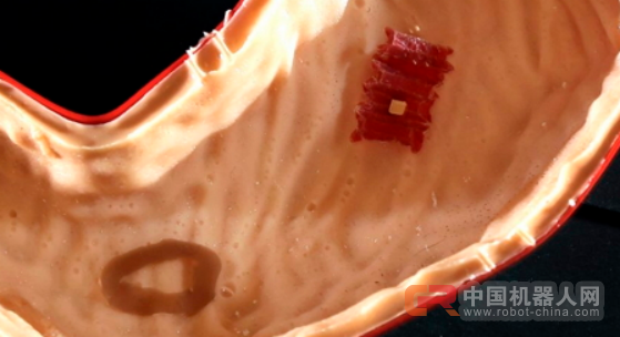 胃不舒服？来吞了这个机器人！