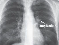 AI医疗来袭,患者、机构、数据科学家分别有哪些新机会?