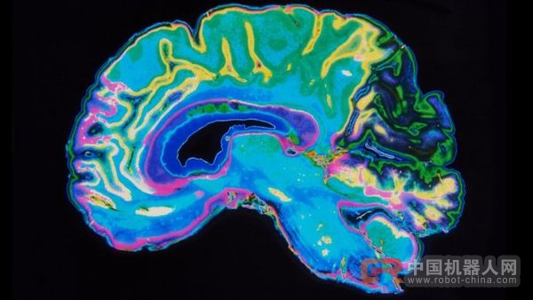 算法可以使用脑部扫描识别有自杀念头的人