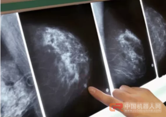 AI面临的挑战：无人车闯祸，我们该找谁？如何保证不再发生？