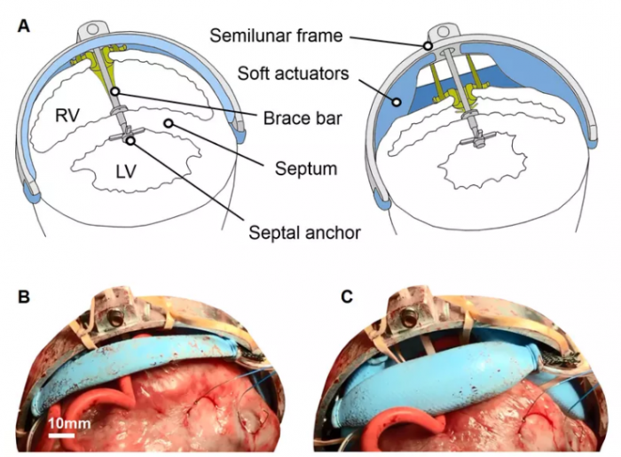 这个机器人可以通过轻轻挤压帮助保持猪心跳动
