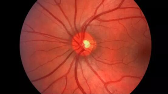 谷歌DeepMind开发AI可有效检测眼疾：对莎普爱思们说再见