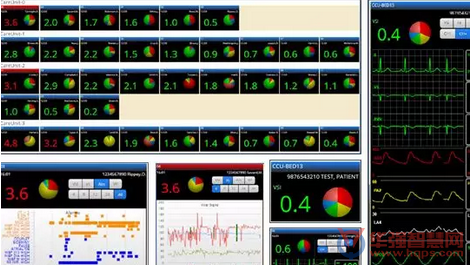 消除医院中的猝死 这个AI系统已获FDA批准